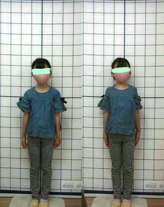 子どもの姿勢や脚の角度／海老名整体とれいん整骨院