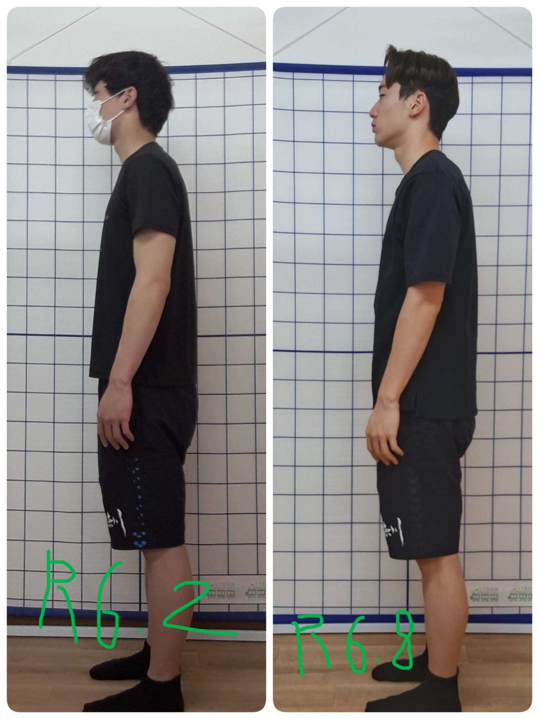 水泳での腰の痛み／高校３年生５０m自由形